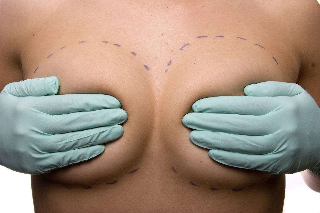 Highlands Ranch Breast Augmentation Options